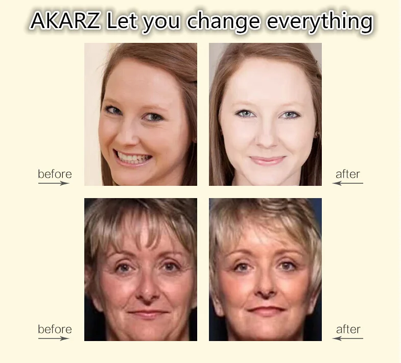 Oroaroma المشيمة مصل استخراج ج - مراجعة Placenta Extract Serum وسعره