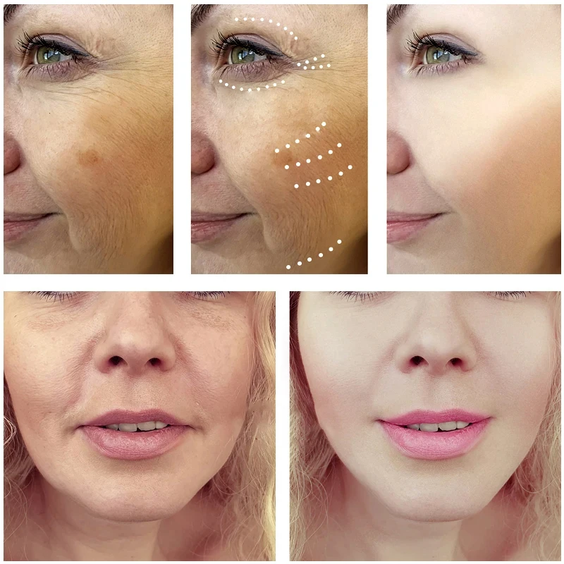 سيروم ترطيب دم التنين الملكي ، - مراجعة Placenta Extract Serum وسعره