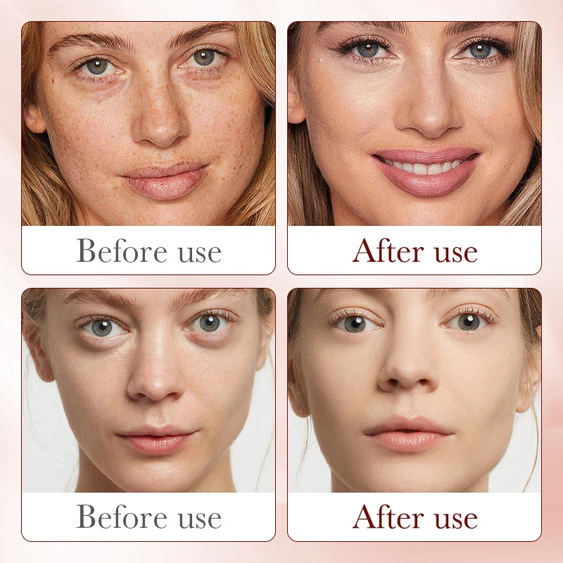 سيروم ترطيب دم التنين الملكي ، - مراجعة Placenta Extract Serum وسعره